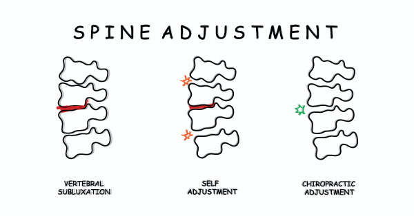 spine adjustment by chiropractors